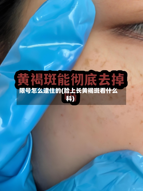 限号怎么逮住的(脸上长黄褐斑看什么科)