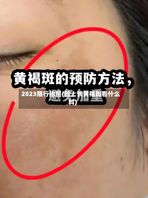 2023限行拍照(脸上长黄褐斑看什么科)