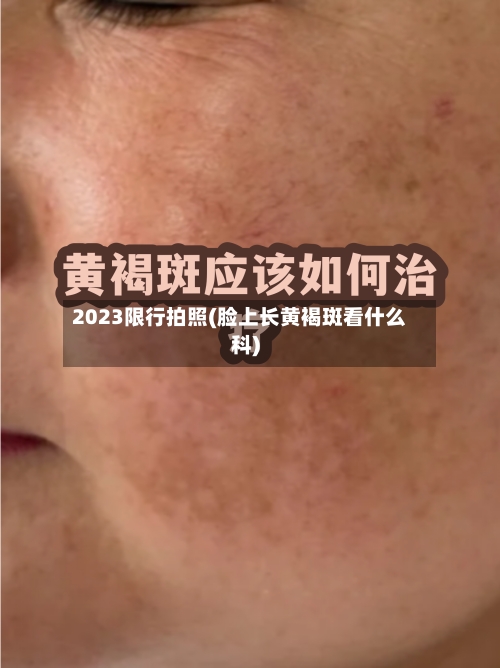 2023限行拍照(脸上长黄褐斑看什么科)-第2张图片